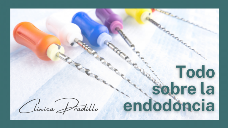todo sobre la endodoncia en Clínica Pradillo