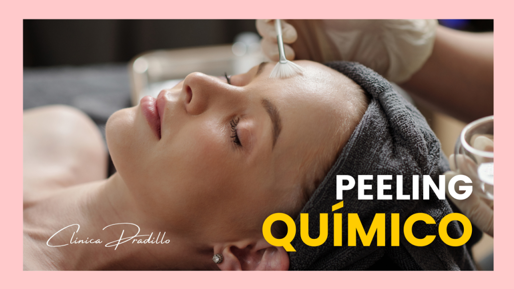 Mujer buscando una piel perfecta mediante un tratamiento de peeling químico en Clínica Pradillo