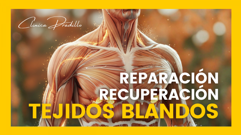 reparación y recuperación de tejidos blandos en pacientes en Clínica Pradillo, Chamartín
