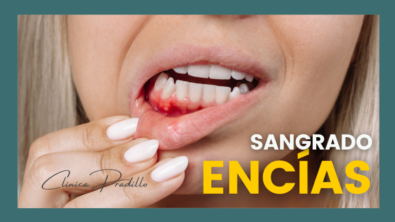 si crees que es normal que te sangren las encías debes saber que no lo es