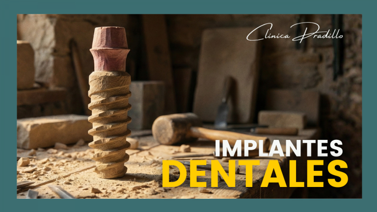 Consulta de implantes dentales en Madrid en Clínica Pradillo barrio de Prosperidad.