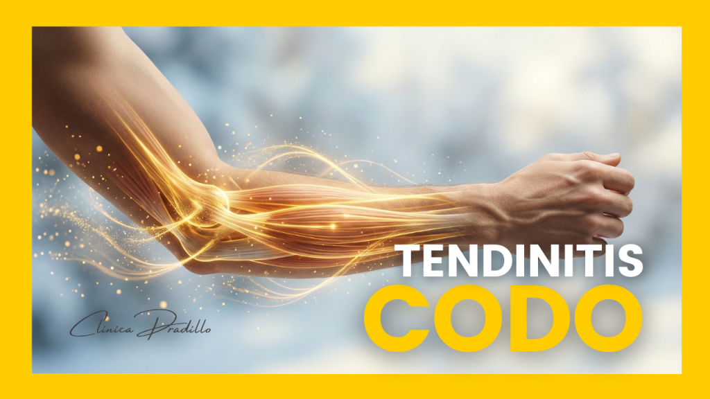 Tratamiento de fisioterapia para la tendinitis de codo en Clínica Pradillo Madrid