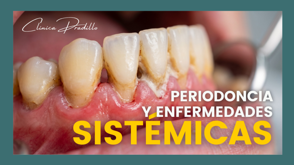 Periodoncia y enfermedades sistémicas: relación entre salud de las encías y salud general