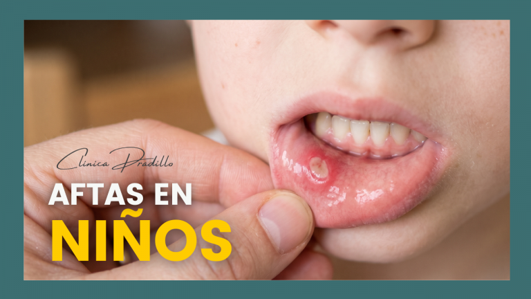 aftas en niños en Clínica Pradillo