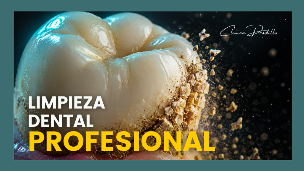 limpieza dental profesional en Clínica Pradillo Madrid