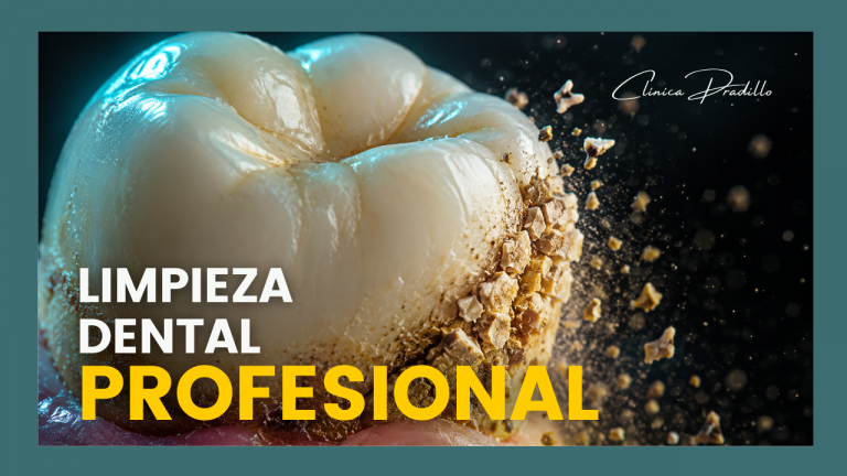 limpieza dental profesional en Clínica Pradillo Madrid
